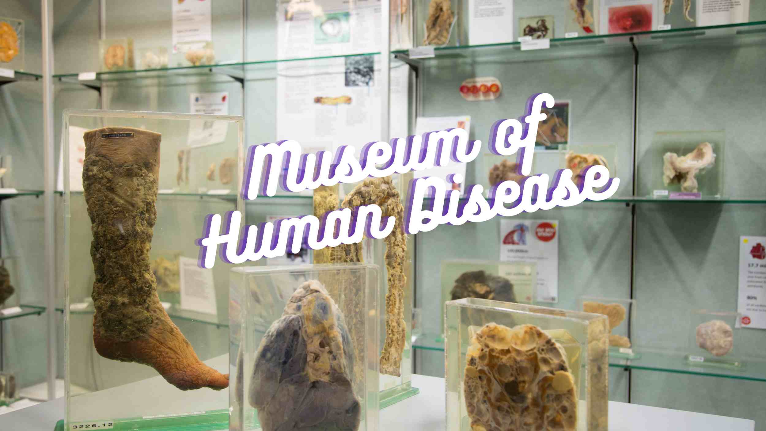 The Museum of Human Disease - Sydney Museums - The Kid Bucket List