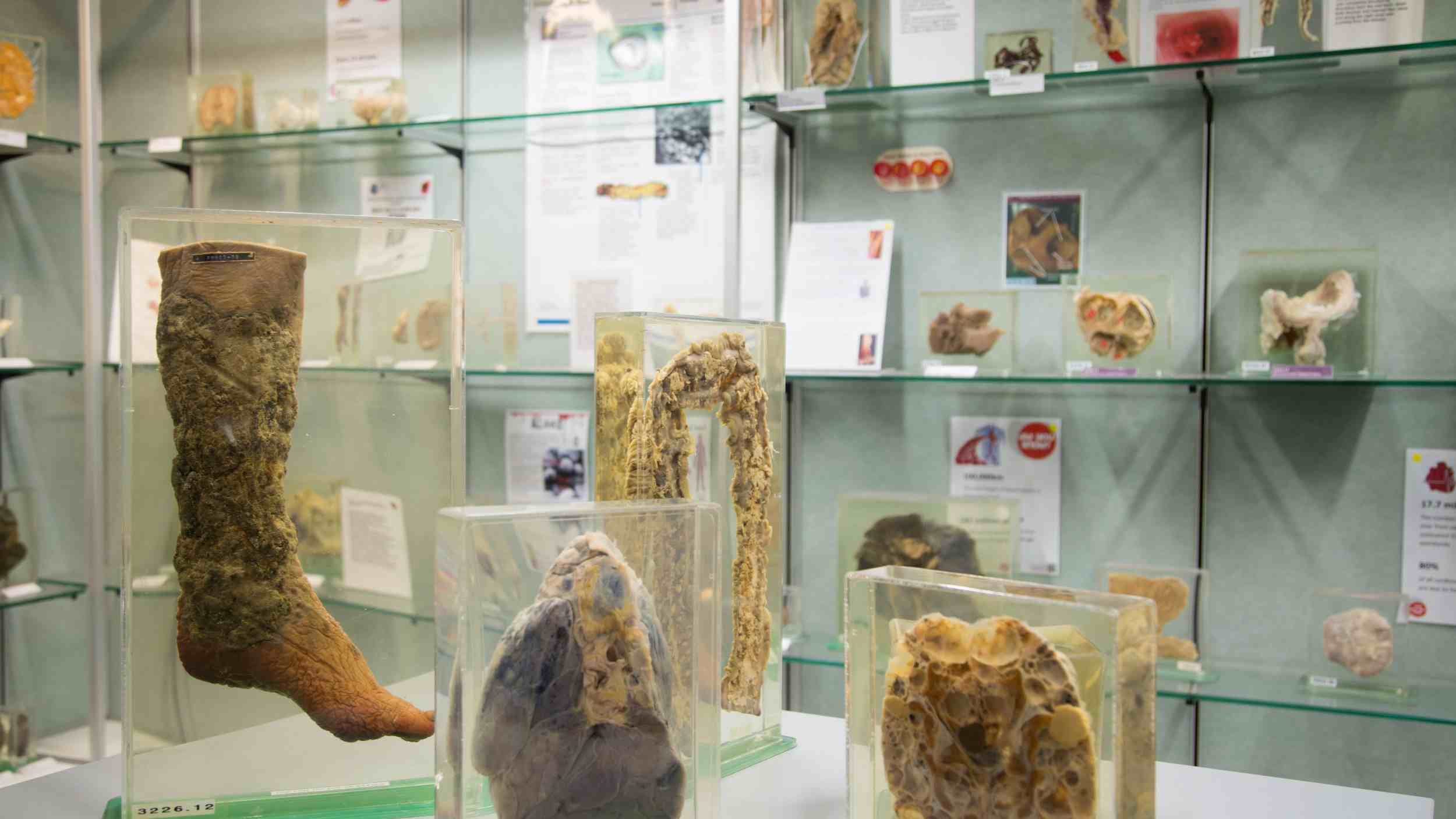 Museum of Human Disease | UNSW Museum | University Museum Sydney